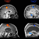 Illustration for article titled Vegetative Patient Answers Yes and No Questions With His Brain